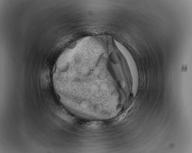 X0000099490128200806121401