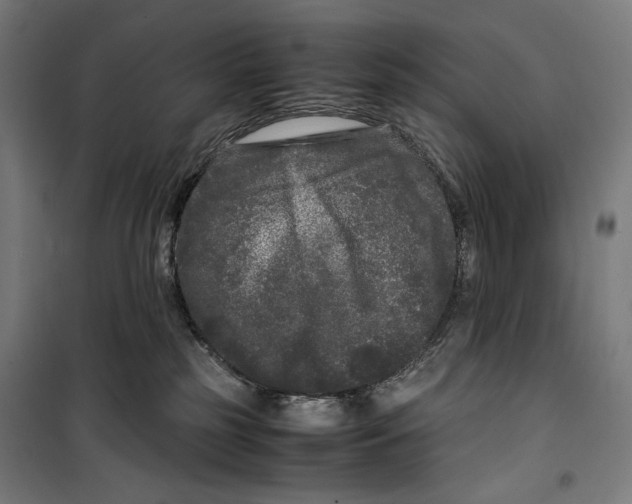 X0000099490185200806121401