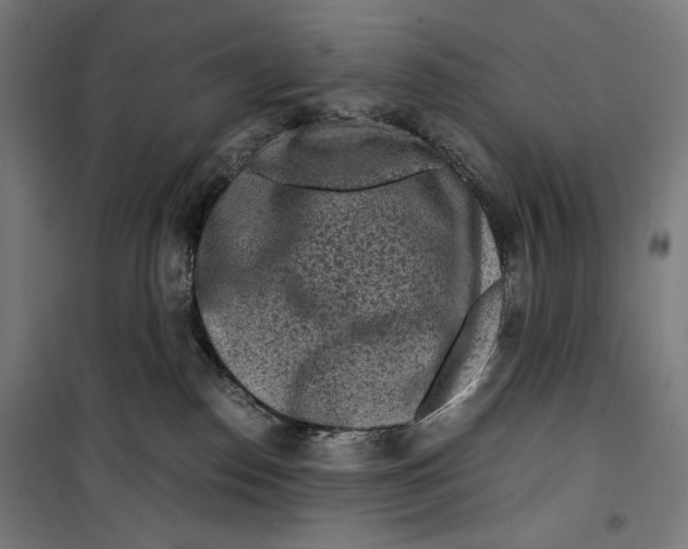 X0000099490186200806121401