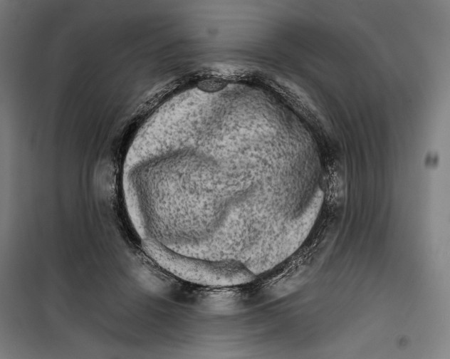 X0000099490456200806121356