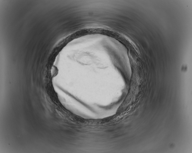 X0000099490775200806121351