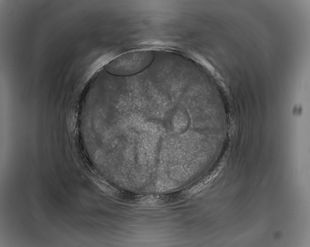 X0000099491259200806121344