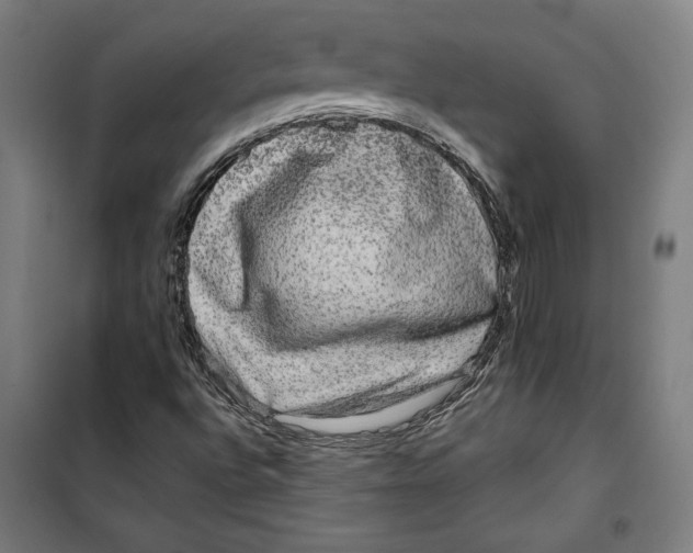 X0000099491496200806121340