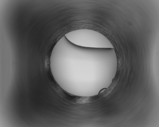 X0000099500138200805150957