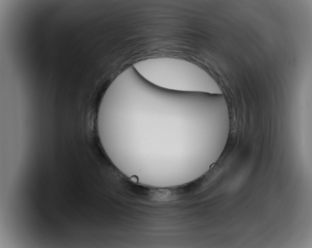 X0000099500230200805150956