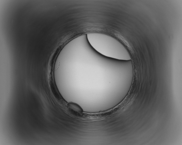 X0000099500490200805150953