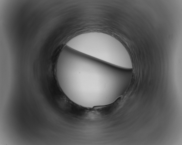 X0000099500572200805150952