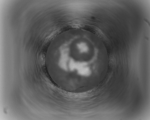 X0000099500043200805151442