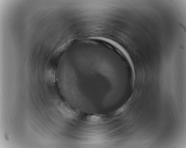 X0000099500180200805151440