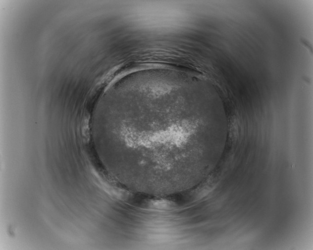 X0000099500360200805151436