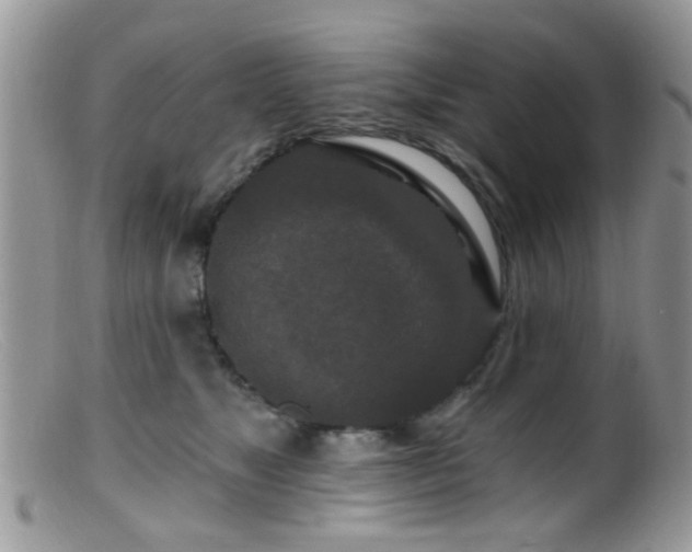 X0000099500517200805151434