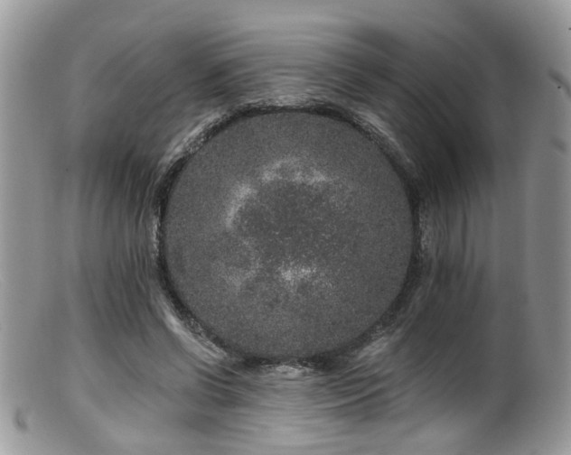 X0000099500542200805151433