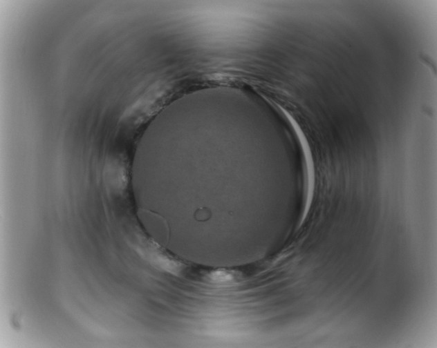 X0000099500566200805151434