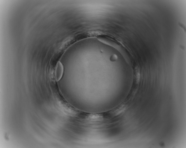 X0000099500619200805151432