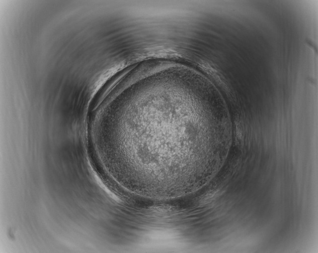 X0000099500630200805151431