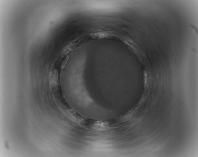 X0000099500760200805151430