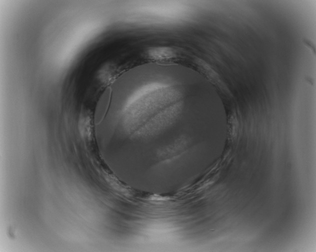 X0000099500762200805151430