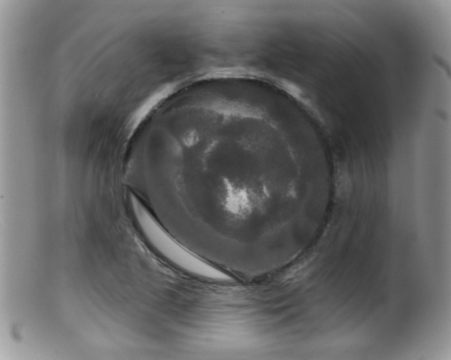 X0000099501221200805151423