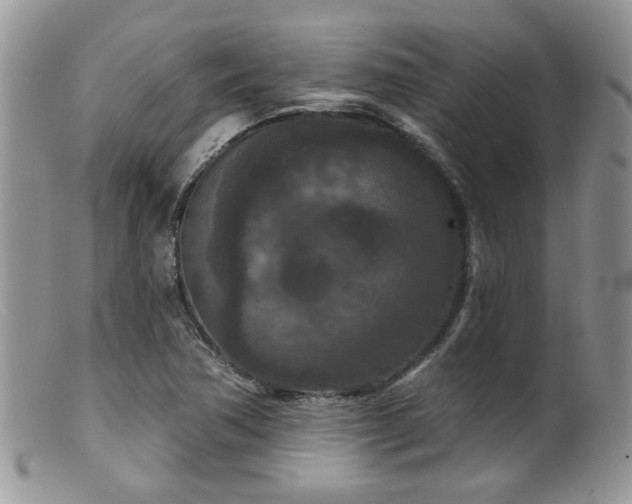 X0000099501362200805151421