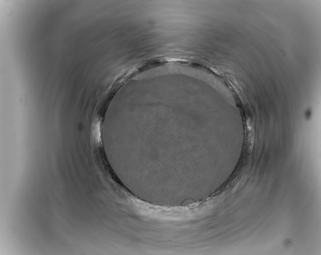 X0000099500042200805221410
