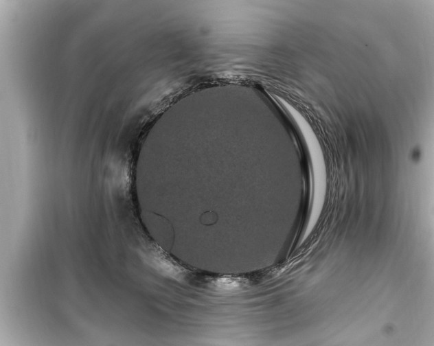 X0000099500566200805221403