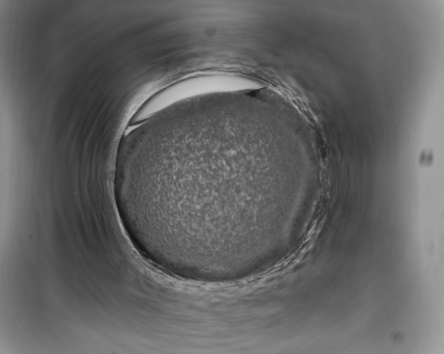 X0000099500003200805291138