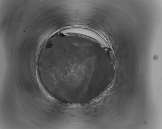 X0000099500097200805291137