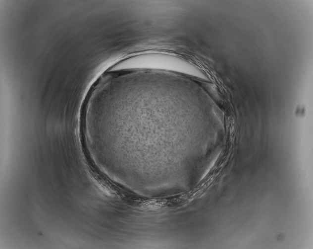 X0000099500148200805291135