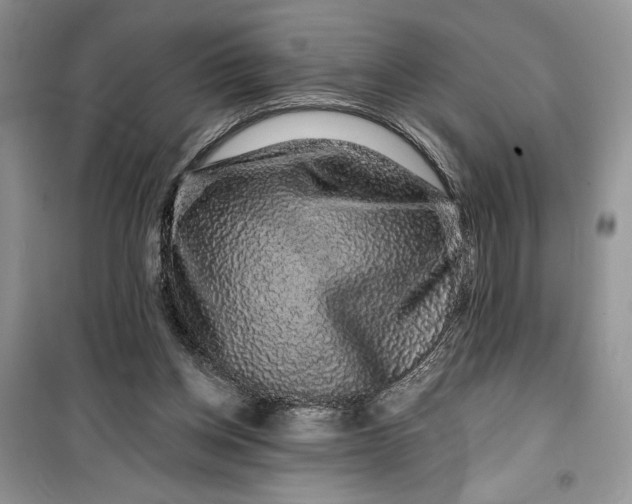 X0000099500158200805291135