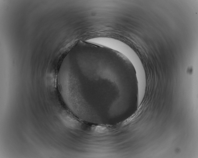 X0000099500180200805291136