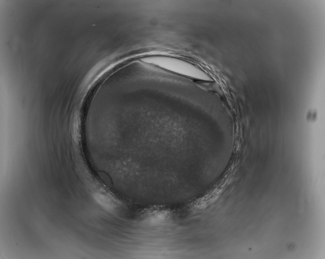 X0000099500247200805291134