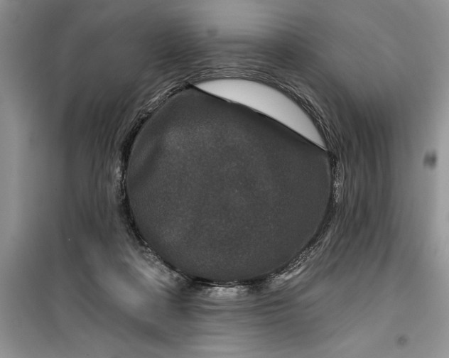 X0000099500314200805291134