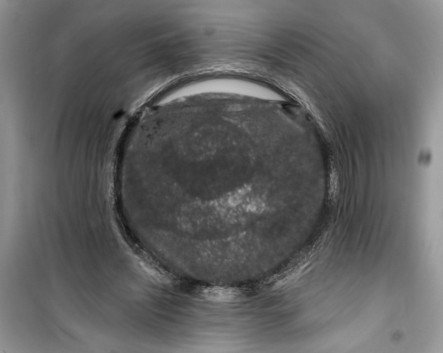 X0000099500444200805291131