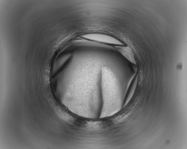 X0000099500450200805291132