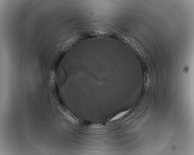 X0000099500563200805291130