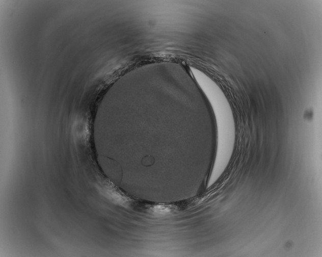 X0000099500566200805291130