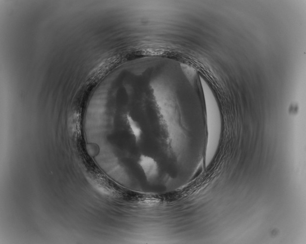 X0000099500598200805291130