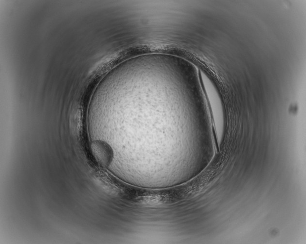 X0000099500740200805291128