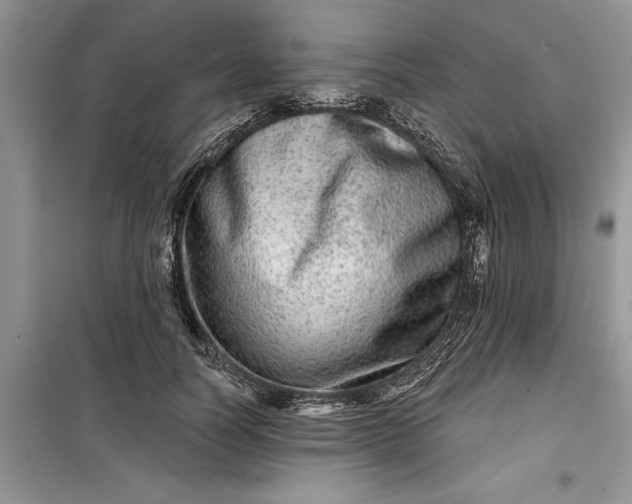 X0000099500746200805291128