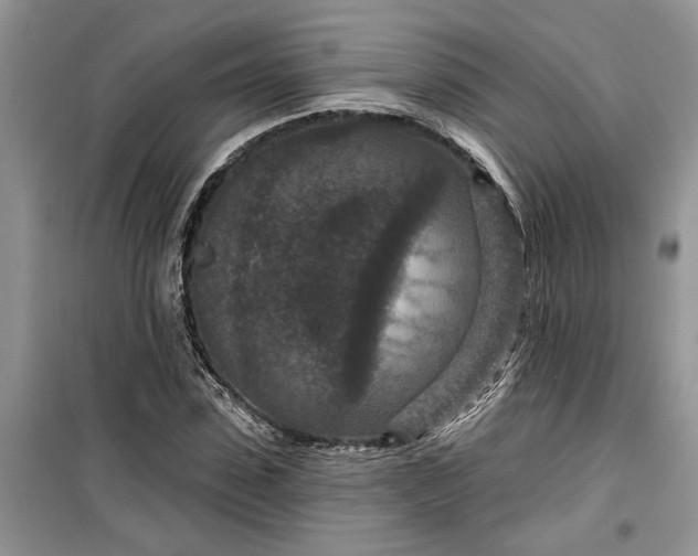 X0000099500923200805291125