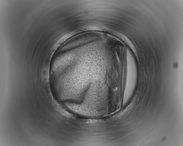 X0000099500938200805291125