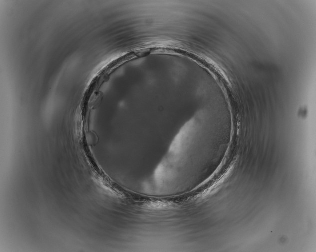 X0000099501117200805291122