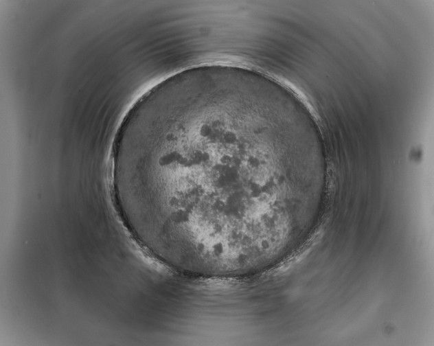 X0000099501125200805291122