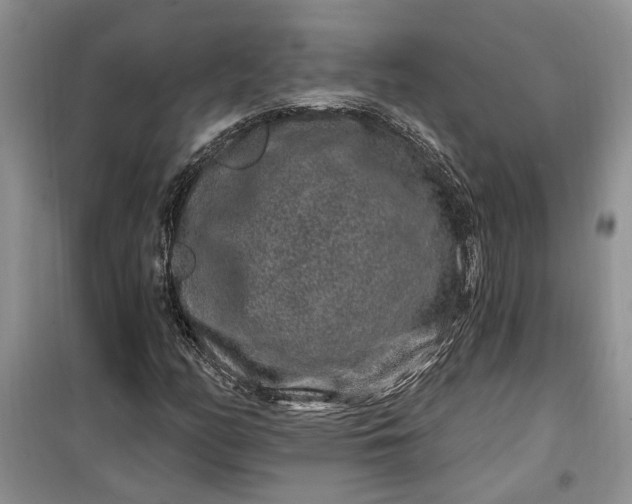 X0000099501158200805291122