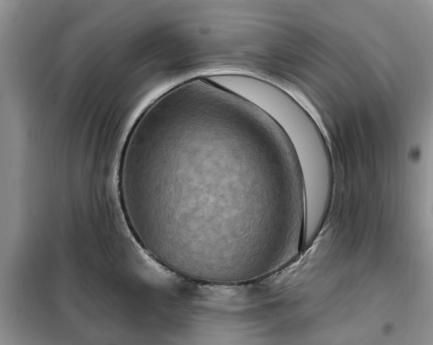 X0000099501197200805291121