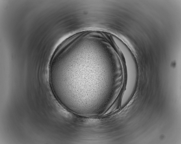 X0000099501238200805291121