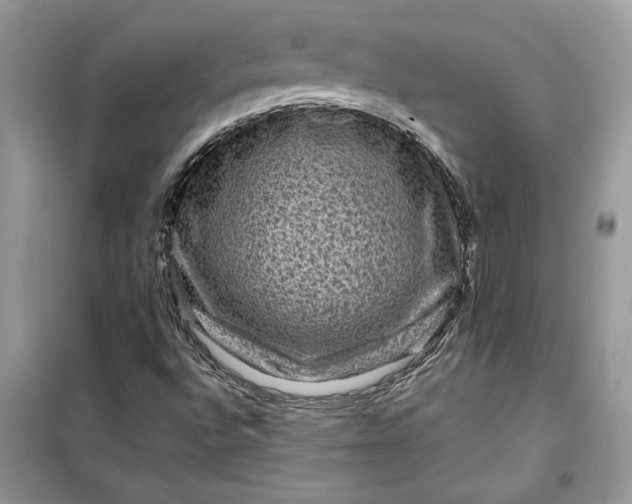X0000099501496200805291116
