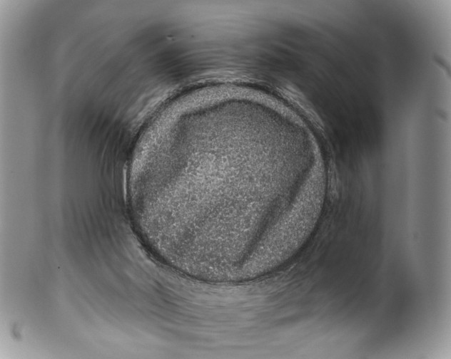 X0000099500014200806051134