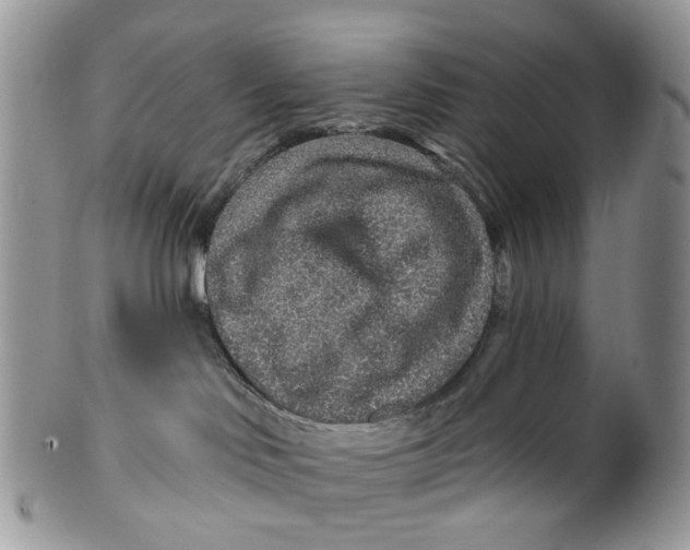 X0000099500046200806051133