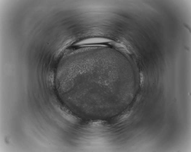 X0000099500072200806051133